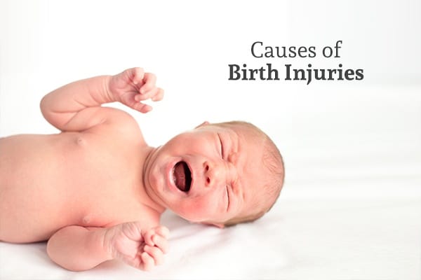 A crying baby against a white background beneath the words "Causes of Birth Injuries"