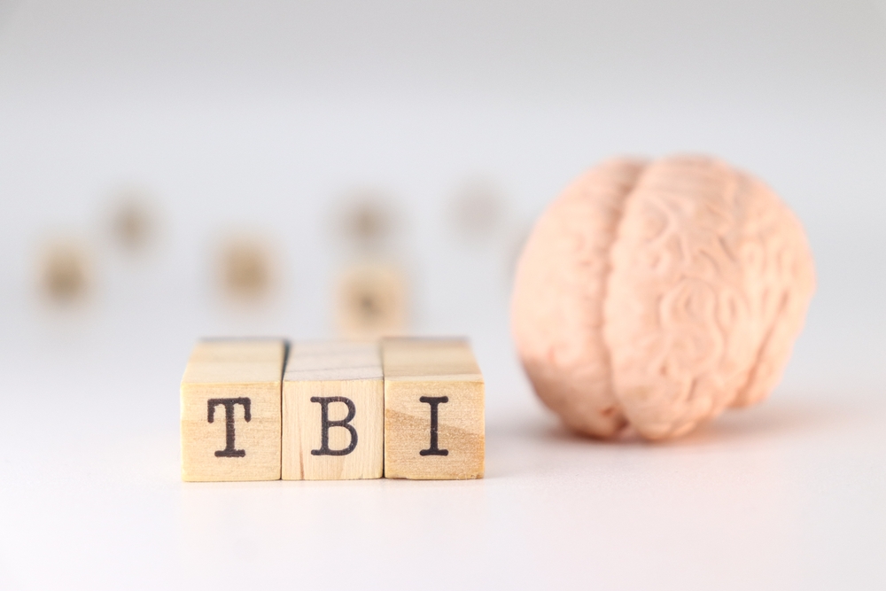 Wooden blocks with TBI letters in front of a brain model, representing traumatic brain injury cases