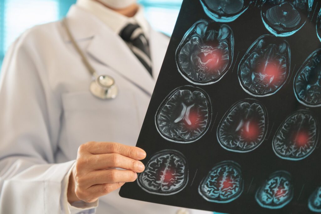 Understand how Texas law applies to boating collisions, equipment failures, and water-related injuries.