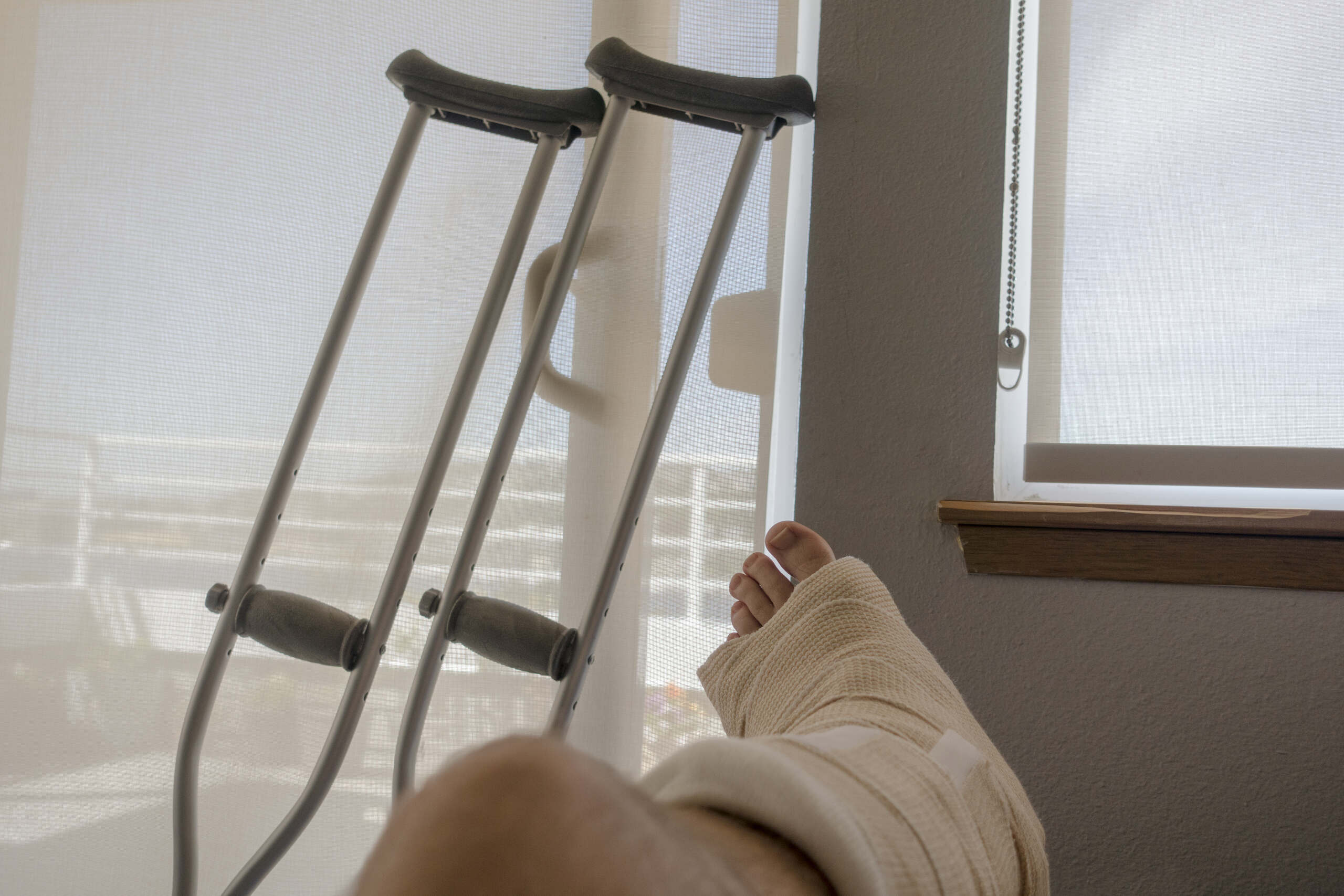 A person’s leg in a medical cast resting near crutches, showing what qualifies as a personal injury in Texas.